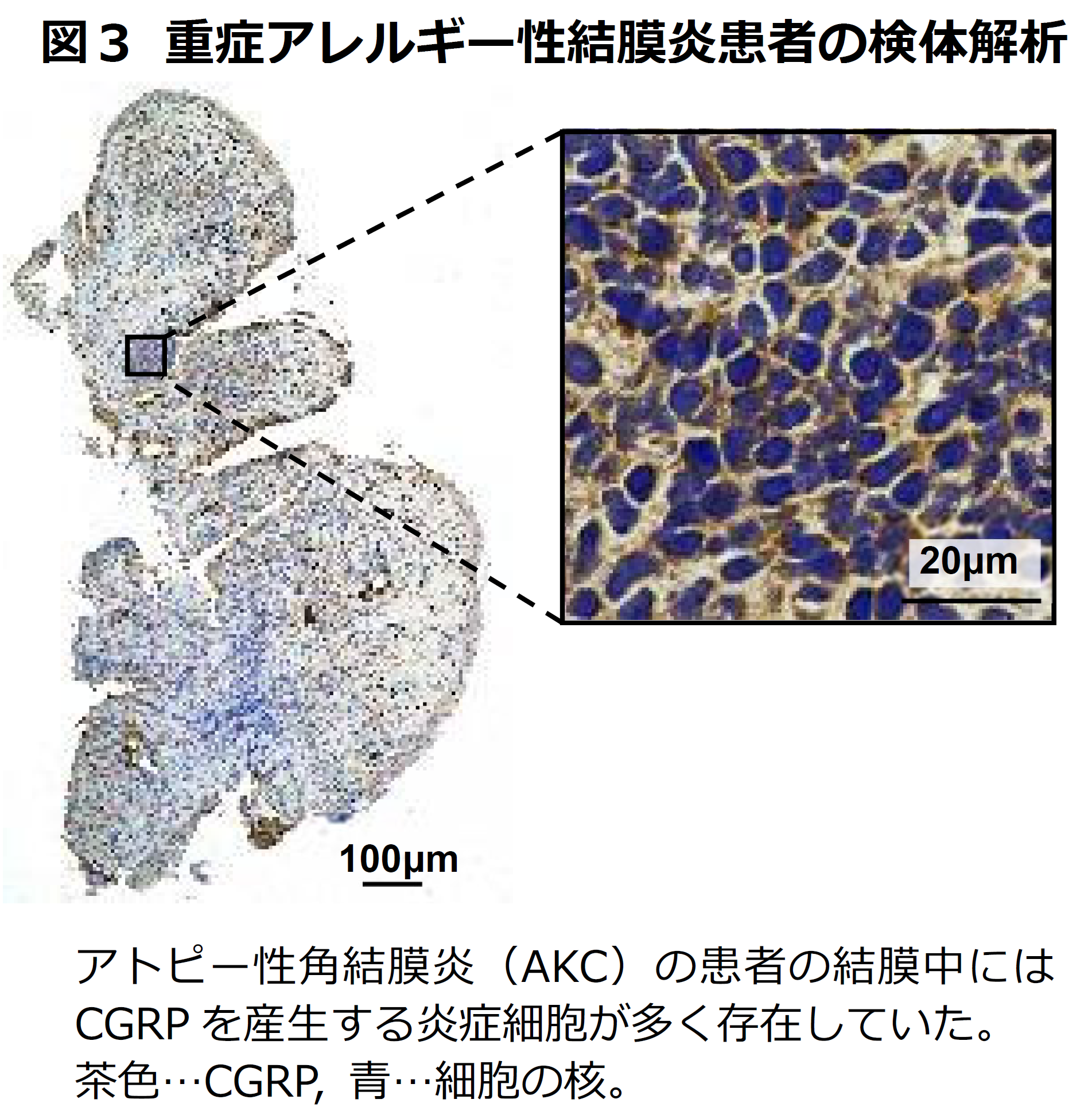 目のつらいかゆみに関わるタンパク質を同定 | 国立大学法人千葉