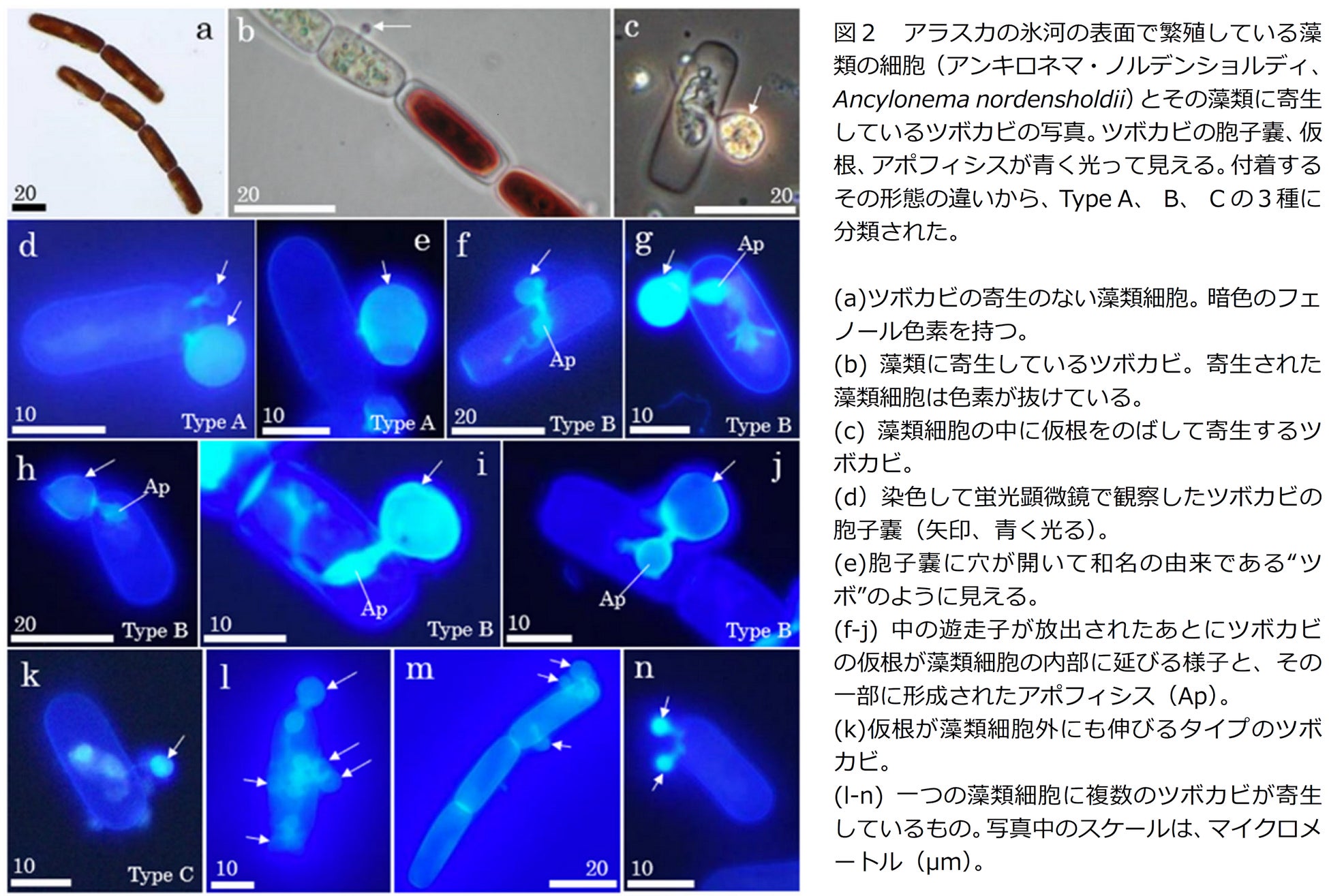 氷河で繁殖している藻類に高い感染率でツボカビが寄生していることを発見