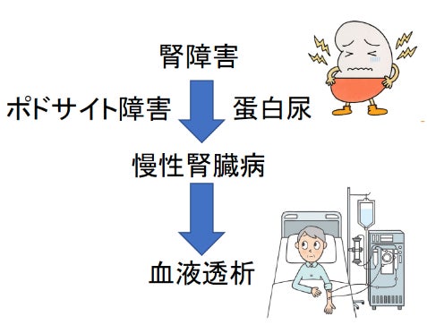 図1:さまざまな腎疾患でポドサイト障害が起き慢性腎臓病が進行していく