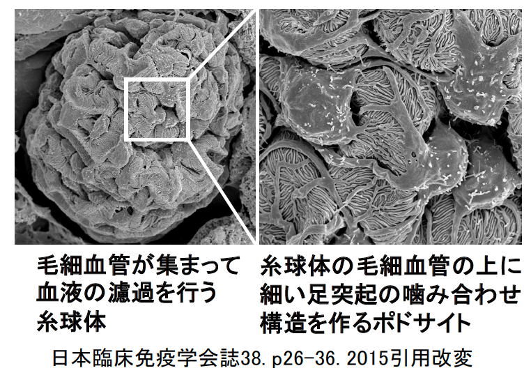 図4：走査電子顕微鏡で見た糸球体とポドサイト