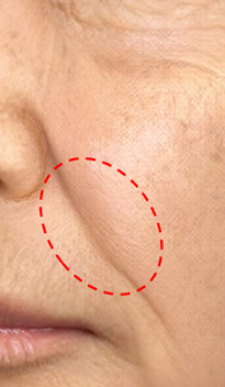 ※実画像を元に作成したCGで再現