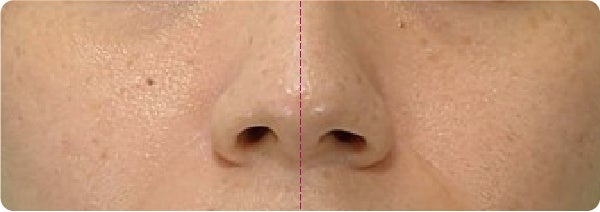 （仕上がりイメージ）左：リズムラスティングウェア塗布、右：無塗布