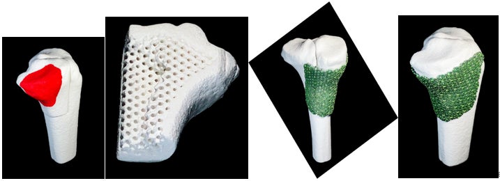 骨再生医療の近未来 ― Smart Bone Bank™ ― | 株式会社ネクスト21の 骨再生医療の近未来 ― Smart Bone Bank™ ― | 株式会社ネクスト21の