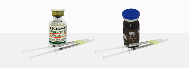 円形脱毛症治療：ステロイド注射＋ミノキシジル注射