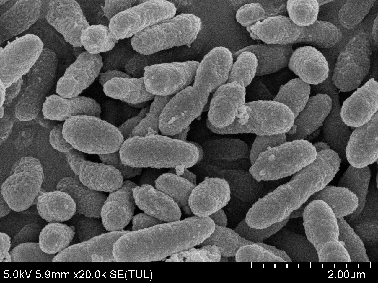 【次世代痩せ菌】アッカーマンシア「AKK PROBIO」のPMOS臨床試験結果を発表！食品開発展2026で特別セミナーも開催