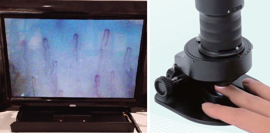 血流観察イメージ