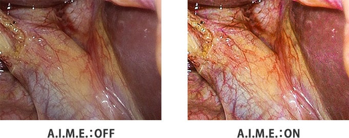 A.I.M.E.　動作例 ※シミュレーション画像