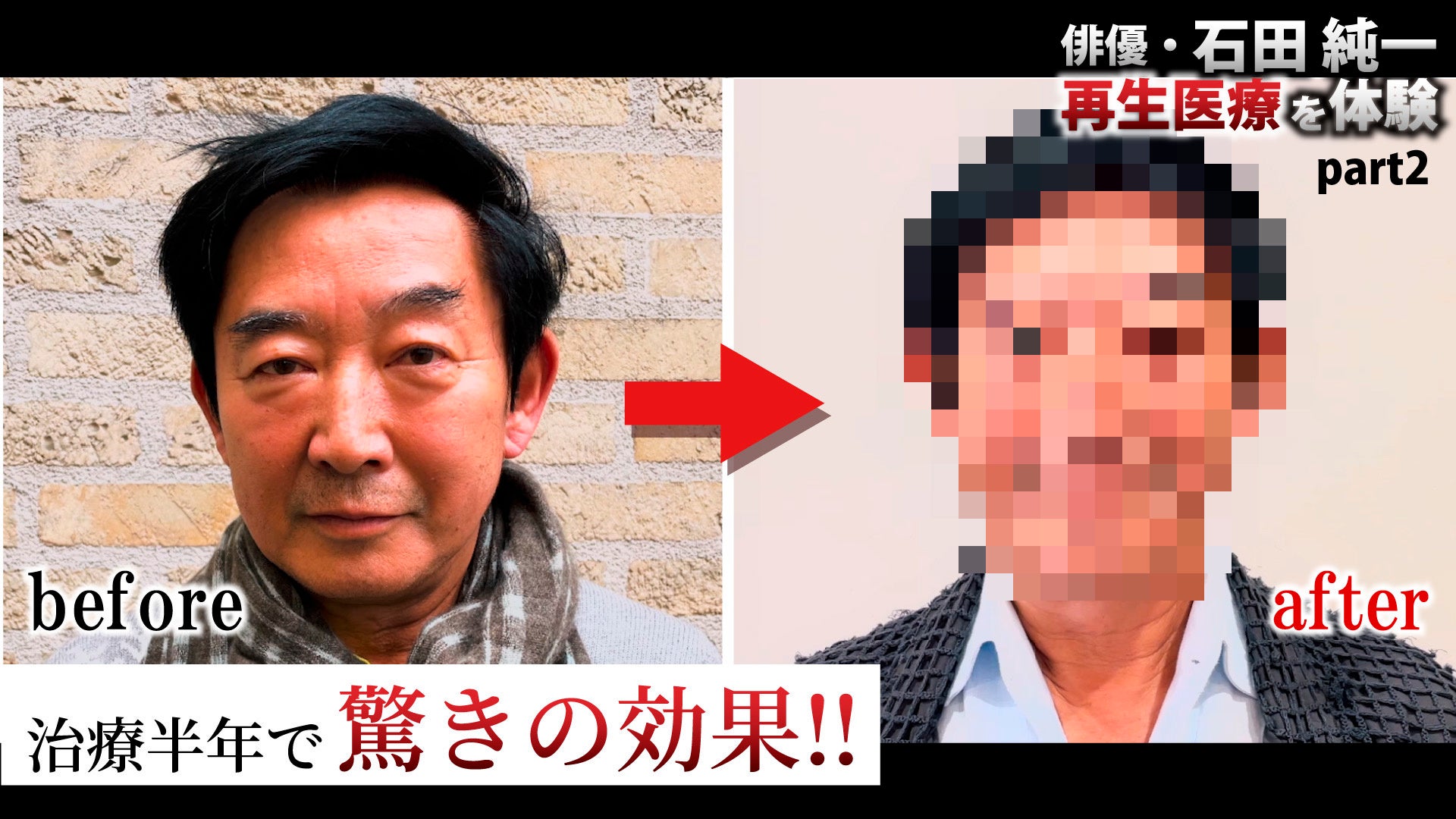 ビフォーアフター