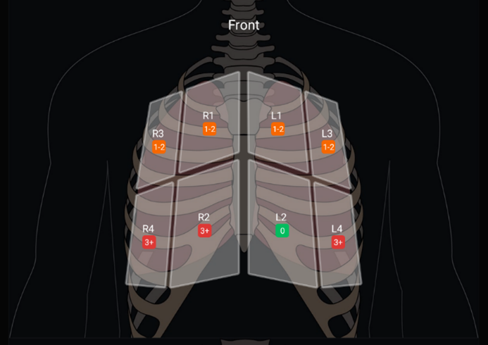「B-Lineカウンティング」機能のレポート画像