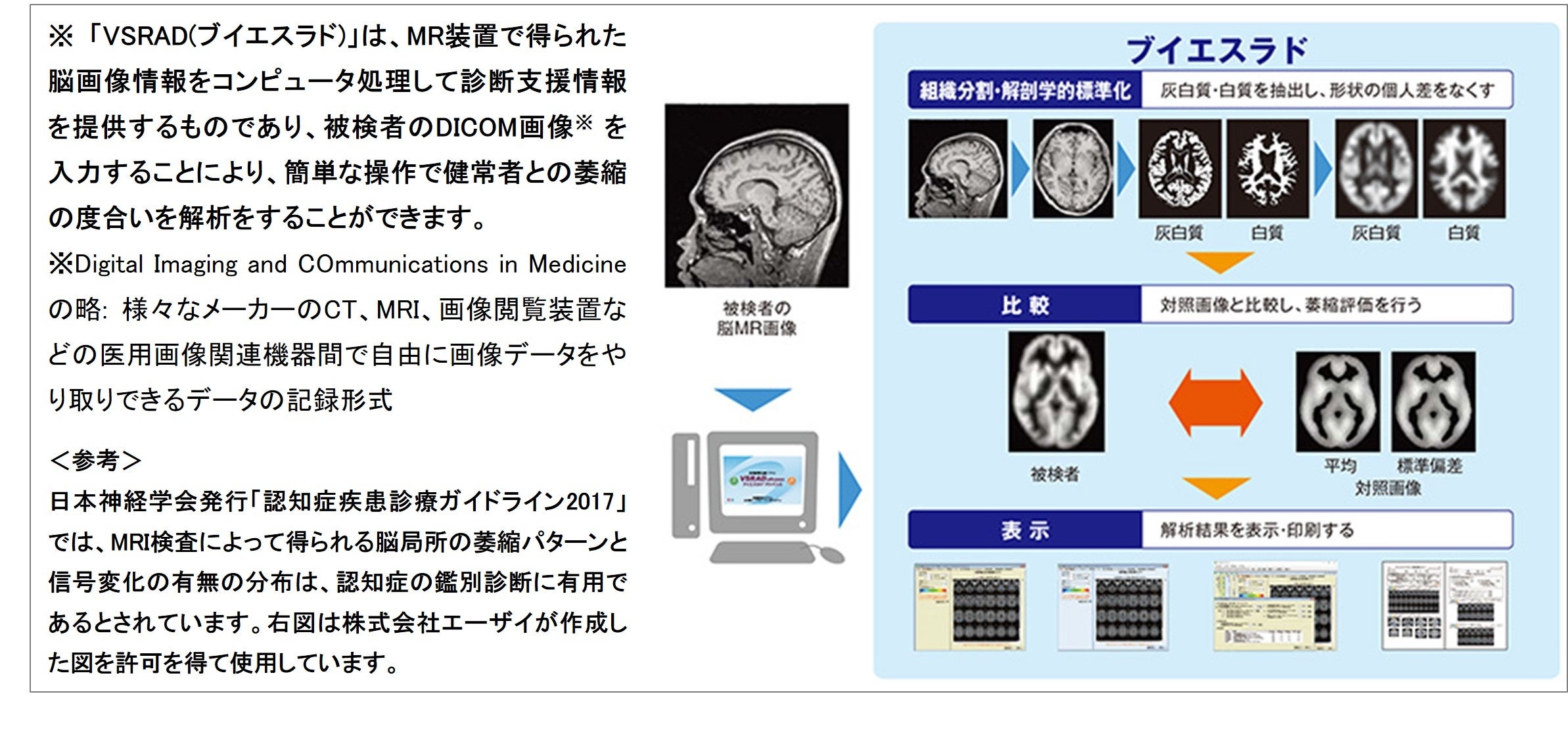 VSRAD(ブイエスラド)