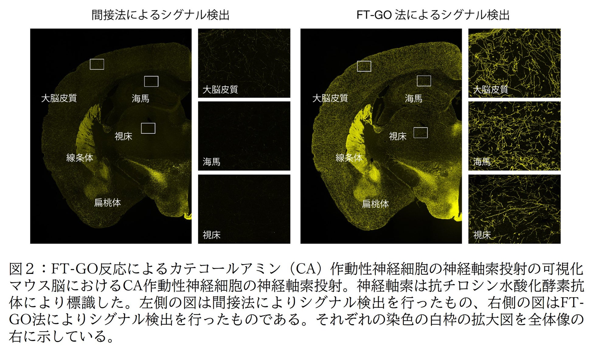 多色蛍光シグナル増幅システムFT-GO法の開発に成功 | 学校法人 順天堂のプレスリリース