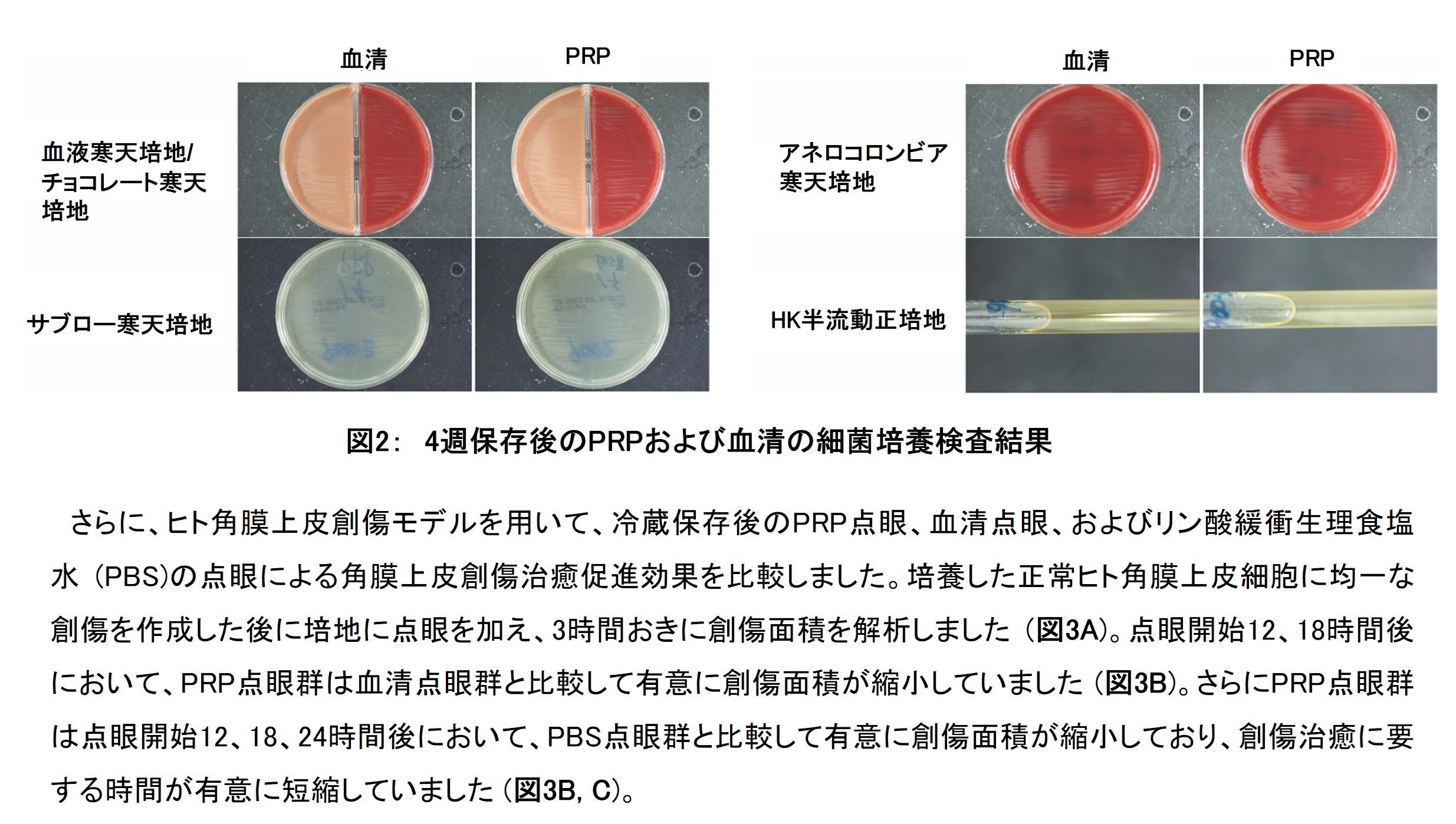 図2：　4週保存後のPRPおよび血清の細菌培養検査結果