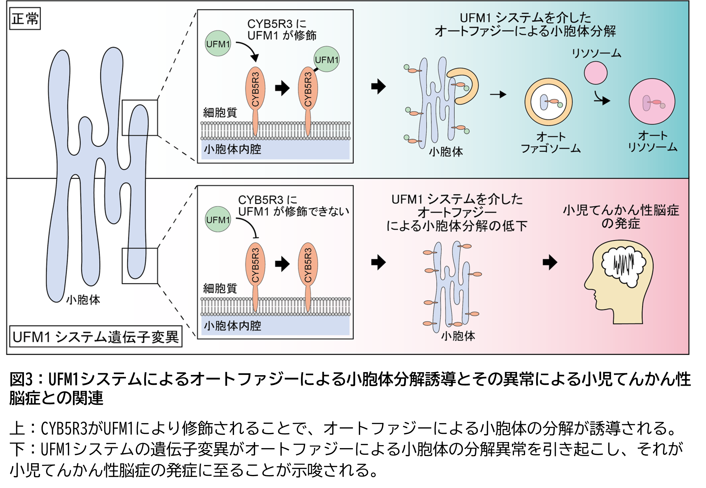 図3： UFM1システムによるオートファジーによる小胞体分解誘導とその異常による小児てんかん性脳症との関連