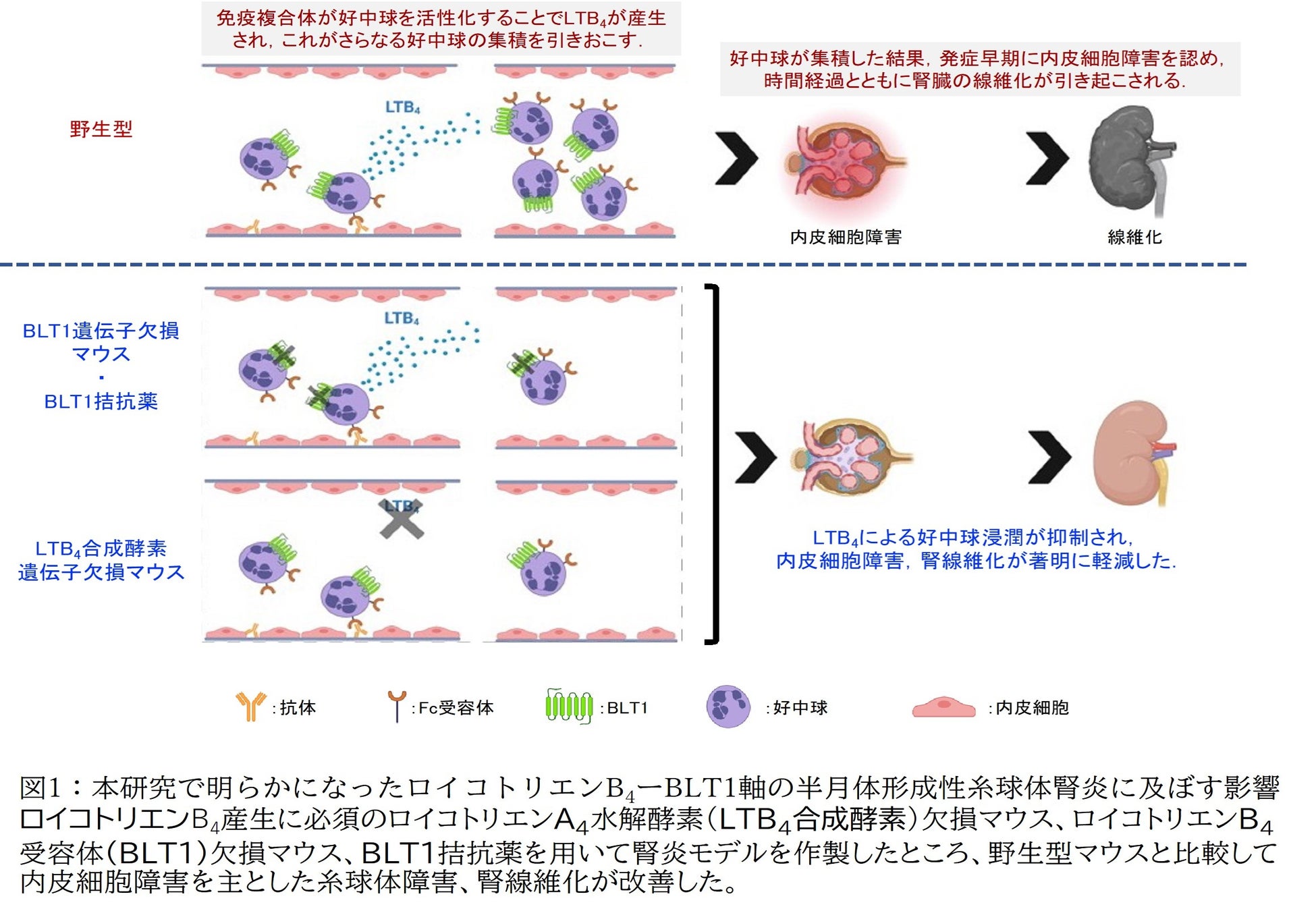 急性腎炎にはどのような種類がありますか