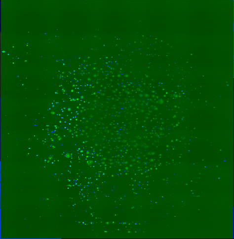 がんの蛍光画像