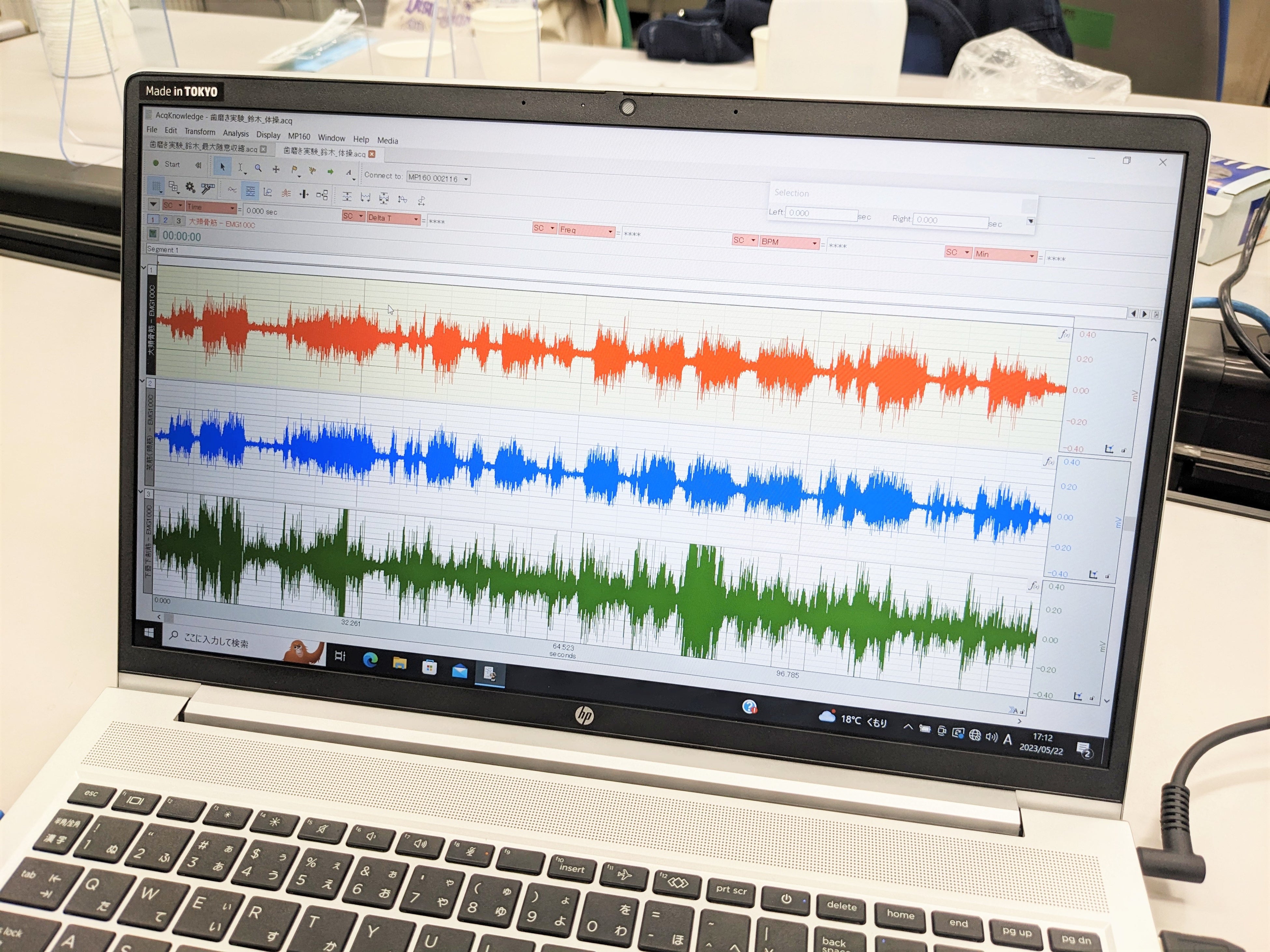 表情筋の活動量を波形測定