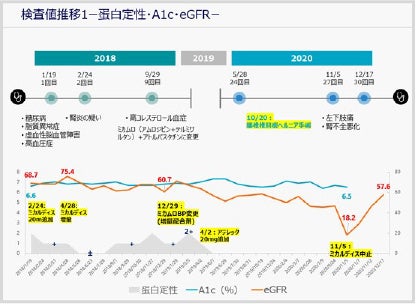 匿名データ加工 イメージ