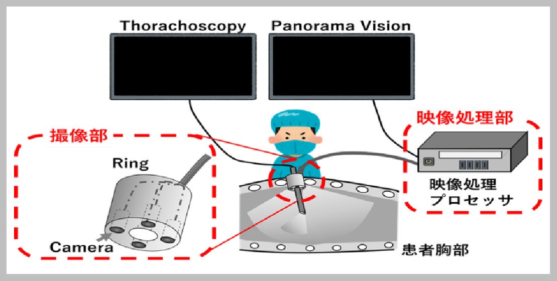 【システム概要 ： 体腔内全体を俯瞰して可視化する】