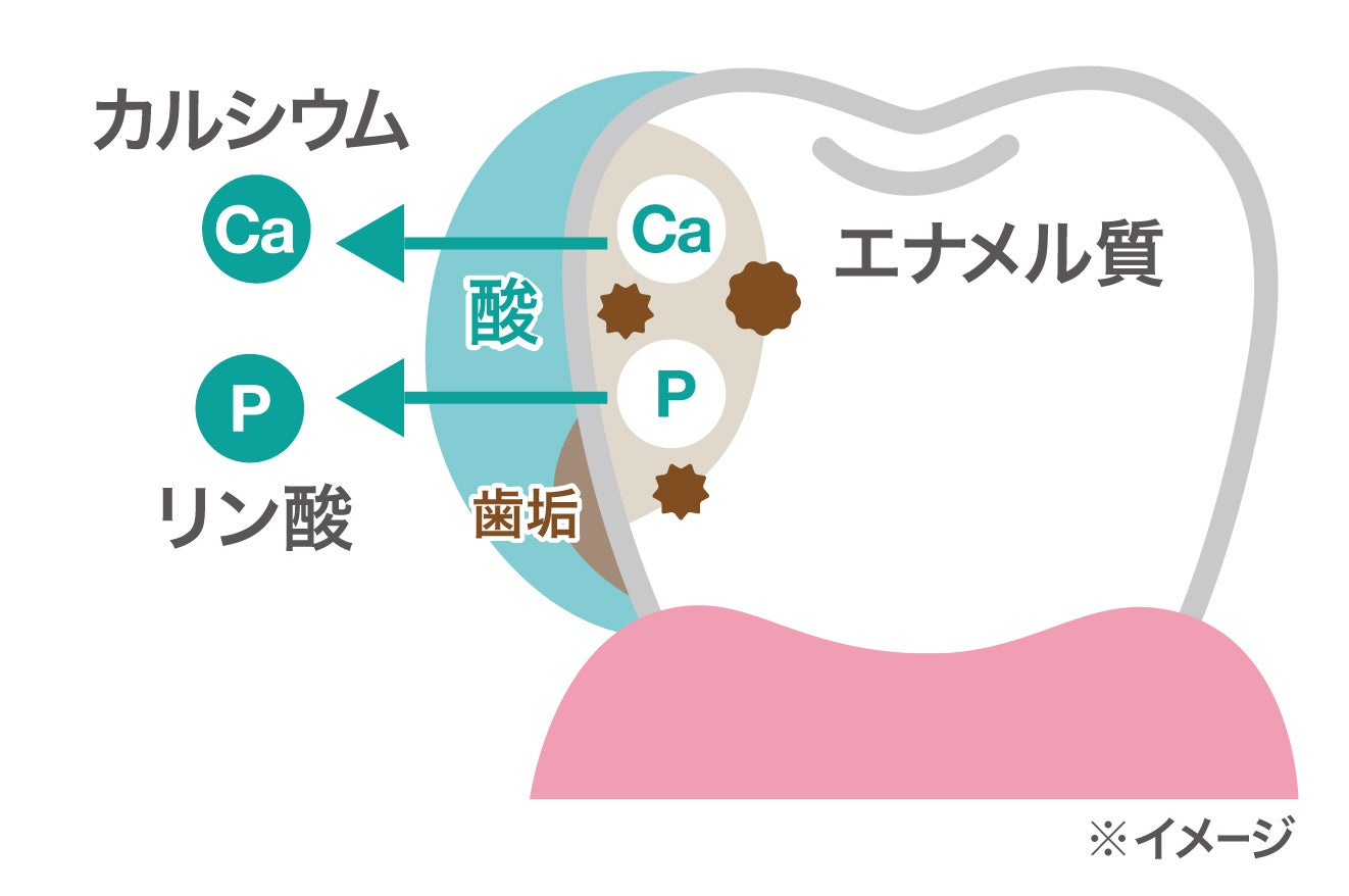 【脱灰について】