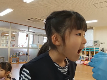 上口唇捕捉テスト