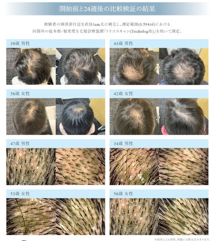 医師監修 発毛サプリ】ヘアバース(3ヶ月分) 医師が開発した 医師監修 発毛サプリ】ヘアバース(3ヶ月分) 医師が開発した