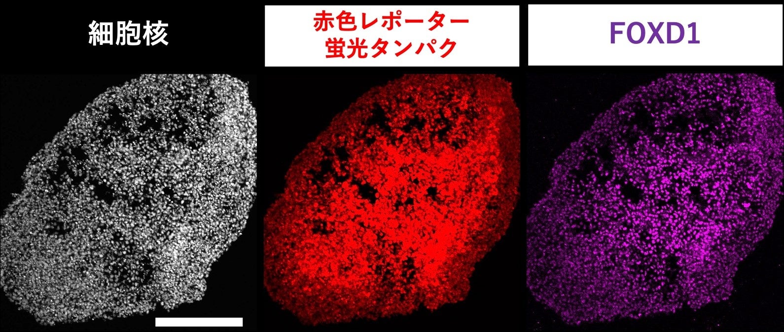 図2 FOXD1を発現すると、蛍光タンパク質が発現するレポーターiPS細胞株