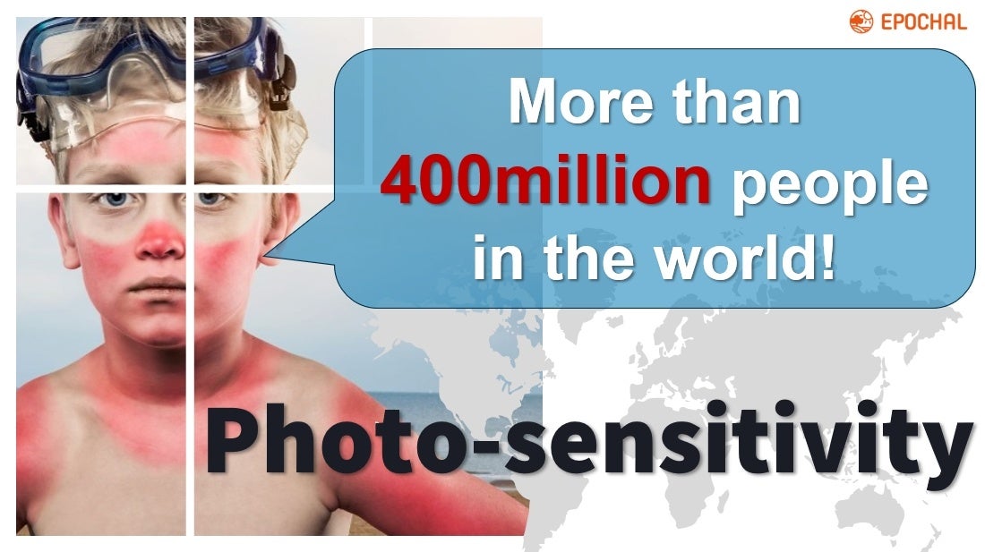 アメリカの光線過敏症の人々について