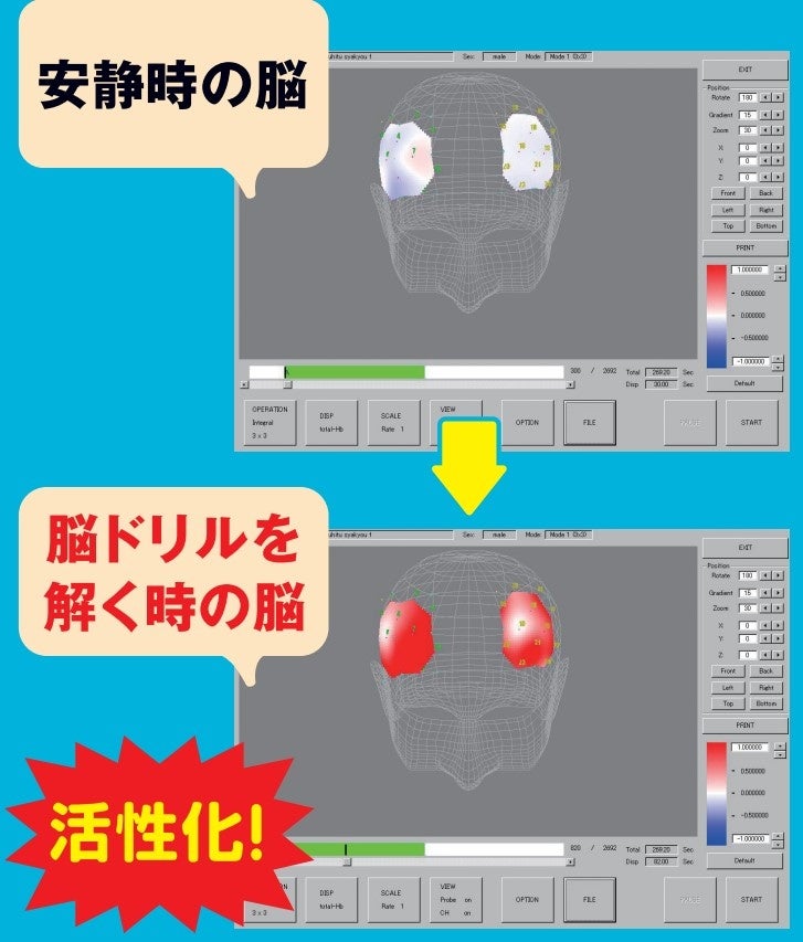 脳機能実験の画像。前頭葉の血流増加効果で脳を活性化。