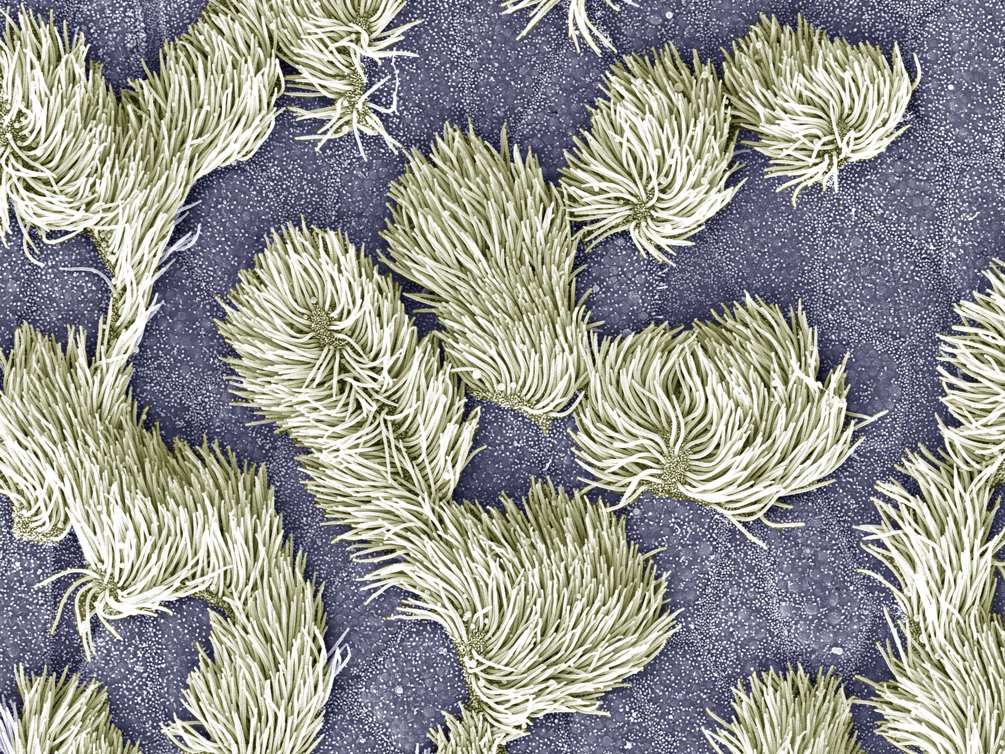 ▲気管の内側の粘膜の細胞にある繊毛まで見える。