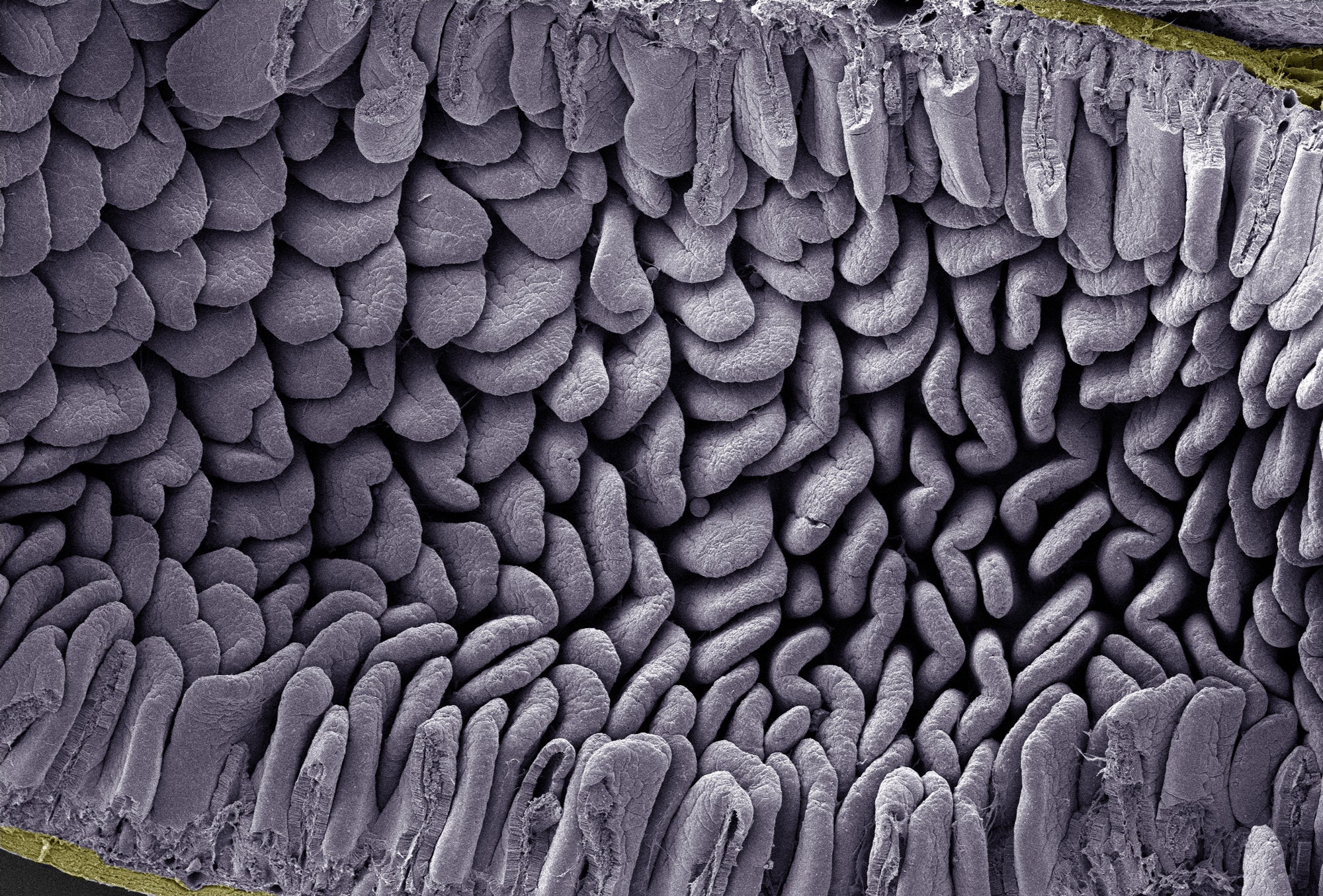 ▲小腸の内側にある沢山の「じゅう毛」のようす。