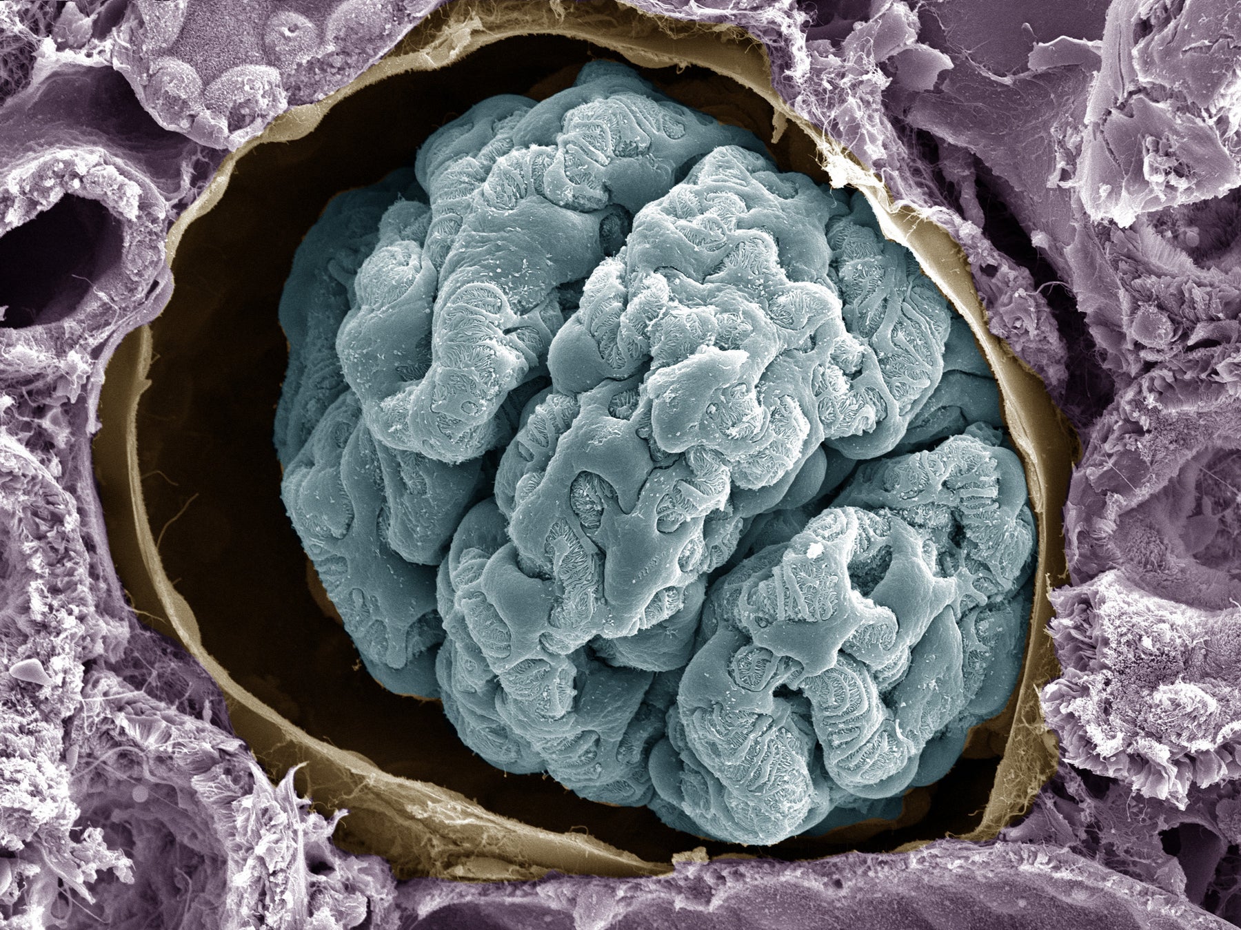 ▲血液からおしっこをつくる腎臓のろ過装置。