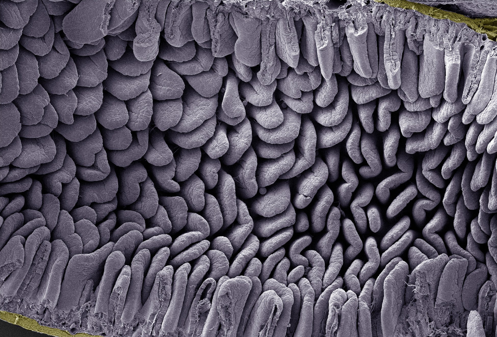 ▲小腸の内側にある沢山の「じゅう毛」のようす。