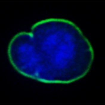 異常形状の核ラミナ