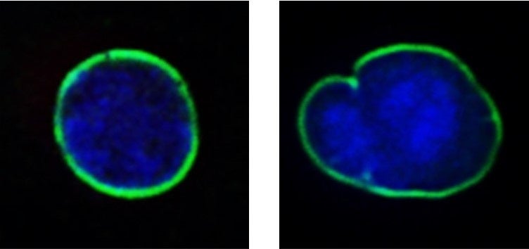 豆乳発酵液が細胞の核ラミナを正常化させることを発見 株式会社ナリス化粧品のプレスリリース