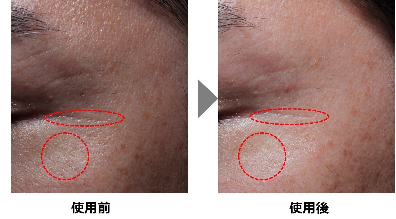 モリンガのシワ改善効果