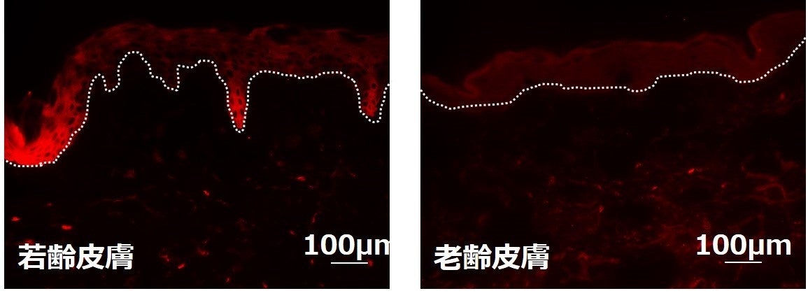 皮膚のMMP-9量の確認（赤色がMMP-9）