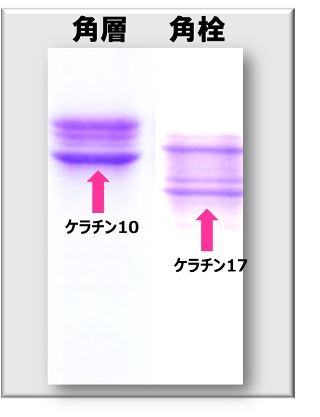 ケラチン17の発現確認