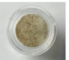 血管細胞あり（メラニン量増加）