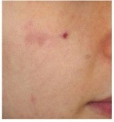 ①茶色ムラを削除した画像