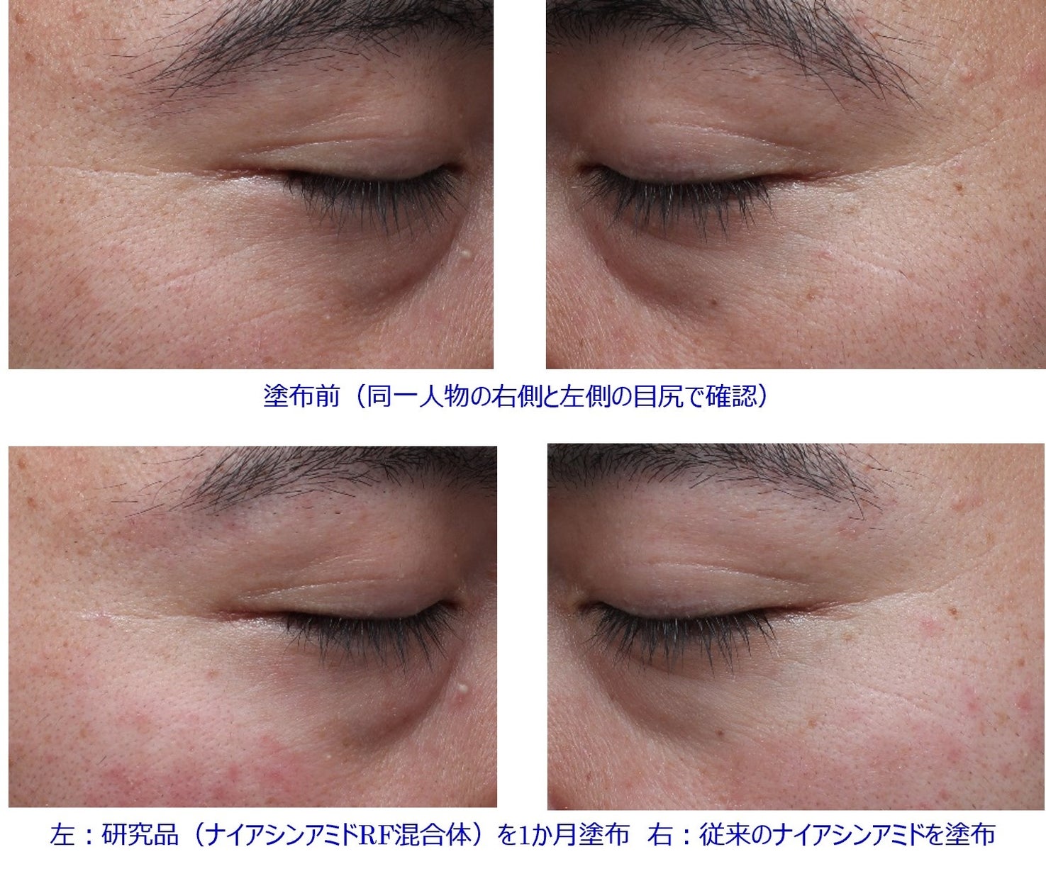 【韓国ドクターズコスメブランド「It’S SKIN(イッツスキン)」】日本市場での販売拡大を本格化。オールインワンマスクをドン・キホーテで先行発売