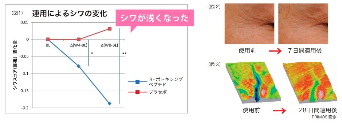 大人の5大目元悩み①深いシワ ②たるみ・ハリ不足 ③乾燥小ジワ