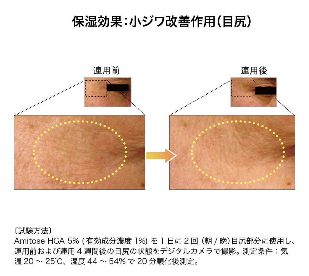 新成分「オートファG VC」で肌のシミ・くすみ、シワが改善