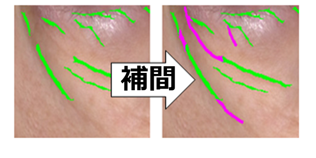 美容皮膚科の目視をデジタル化（例：しわ）