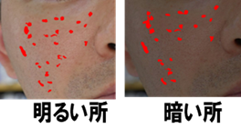 異なる照明環境下で同一検出（例：シミ）
