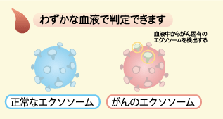 正常なエクソソームとがんのエクソソーム