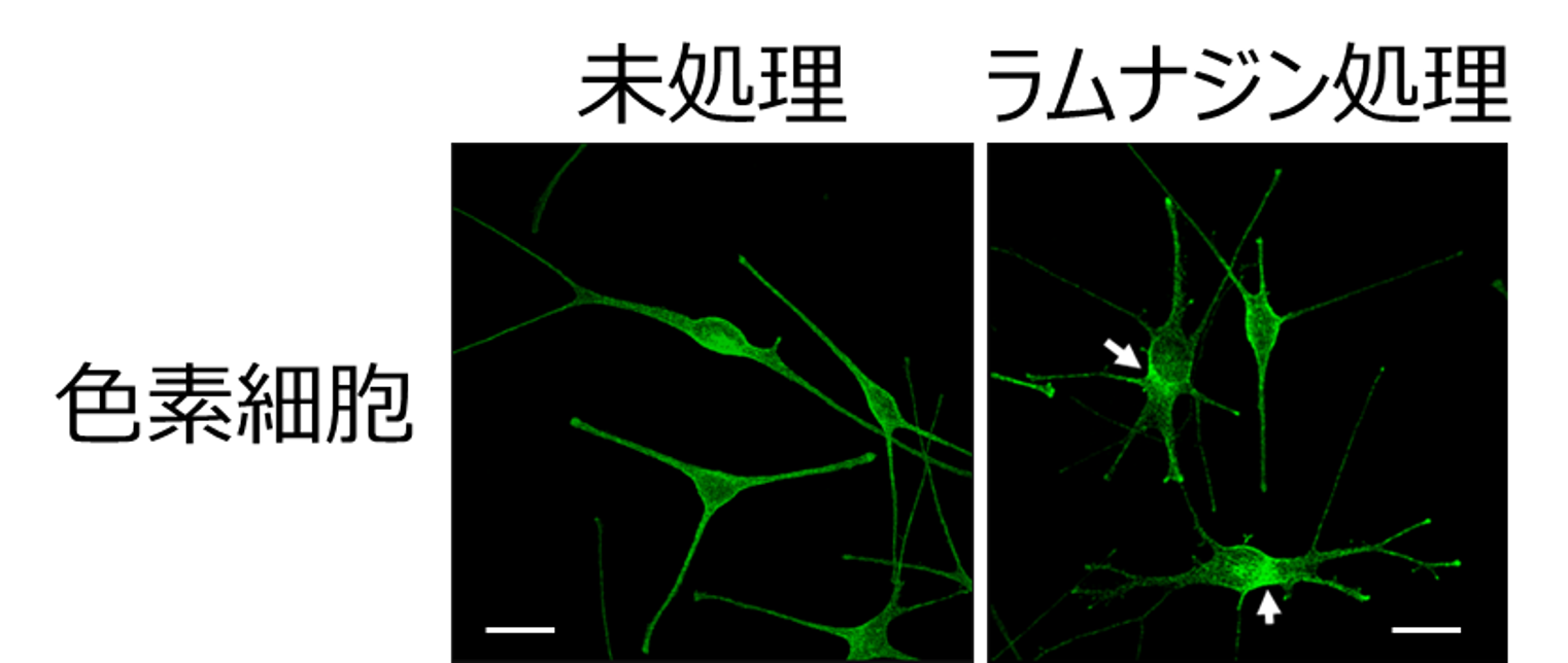 図２. メラノソームの輸送阻害を起こした細胞