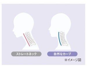 イメージ図_ストレートネック
