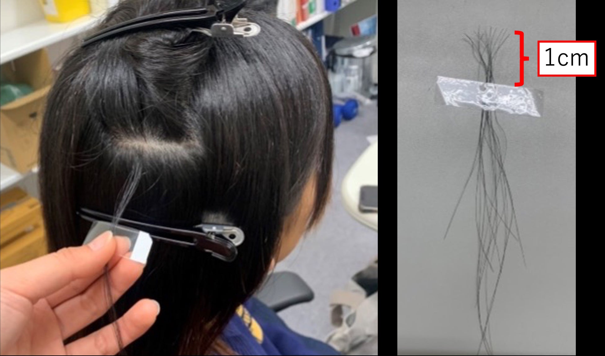 アスリートの長期トレーニングによる身体的負荷量について毛髪の採取の様子