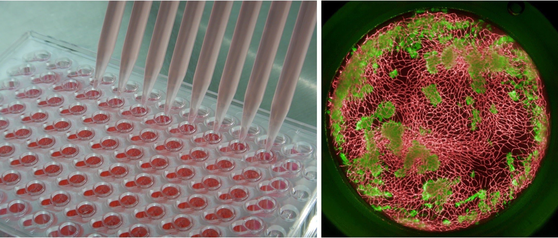 ぐ*う様 マウントルイス　胞子培養株　特大サイズ　個人選抜 ぐ*う様 マウントルイス 胞子培養株 特大サイズ 個人選抜