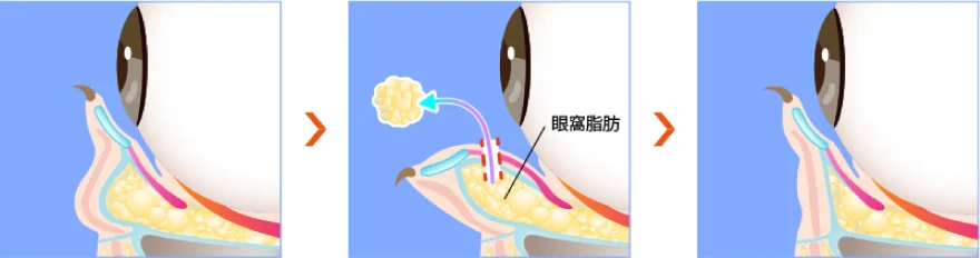 治療のイメージ